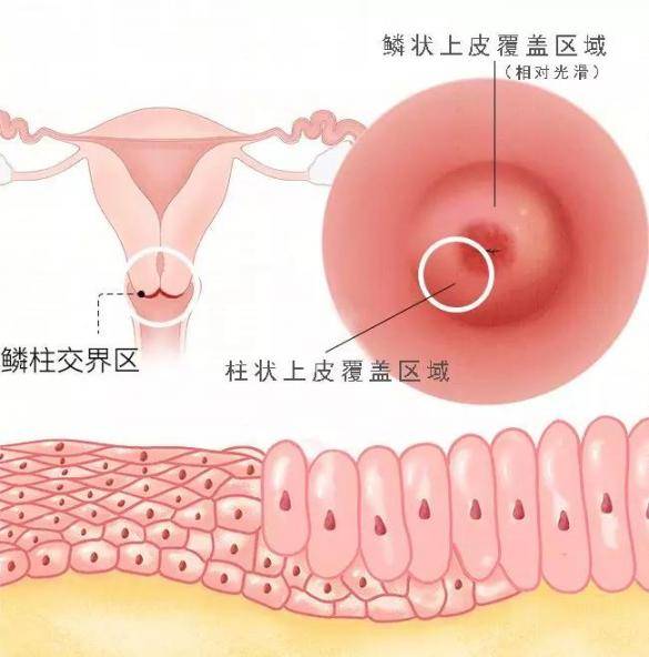乳腺增生、子宫肌瘤……女性这4个身体异常,要不要治得这样判断