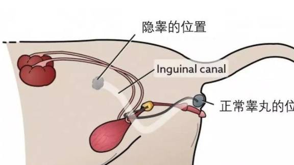 学到了吗（假验孕棒怎么做）如何制作假的验孕棒怀孕 第7张