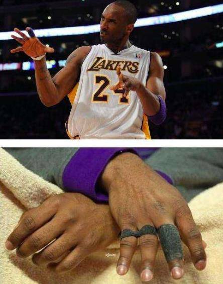 像是科比,詹姆斯,哈登,杜兰特等顶级球员的脚都发生了非常大的变形,看