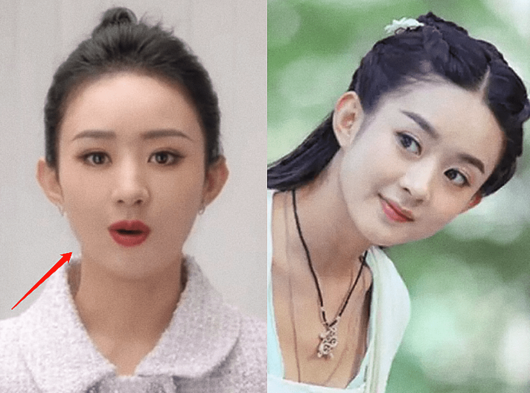 赵丽颖近照变脸引热议!