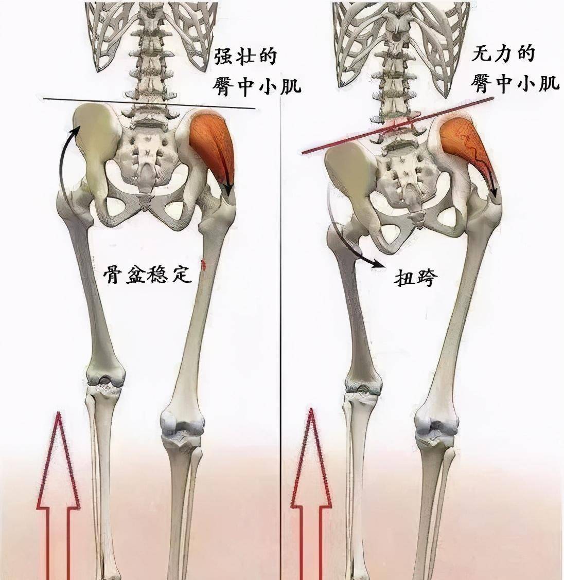 臀大肌无力会影响身材和体态,6个针对性训练,强化臀部肌肉力量_因为