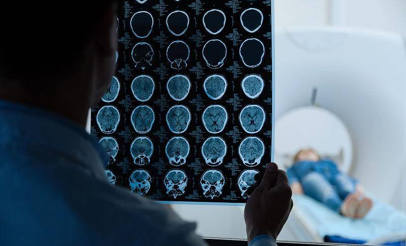 总是丢三落四,10问题测试你是否脑袋宕机_大脑_什么_问卷调查