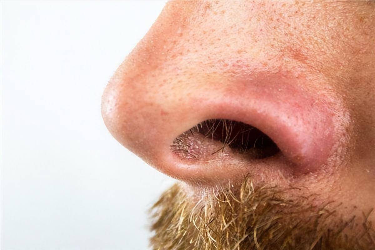 鼻毛变白是衰老的前兆吗?