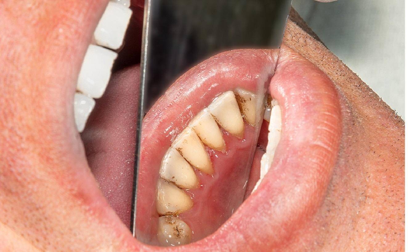 黏牙 来自搜狐网