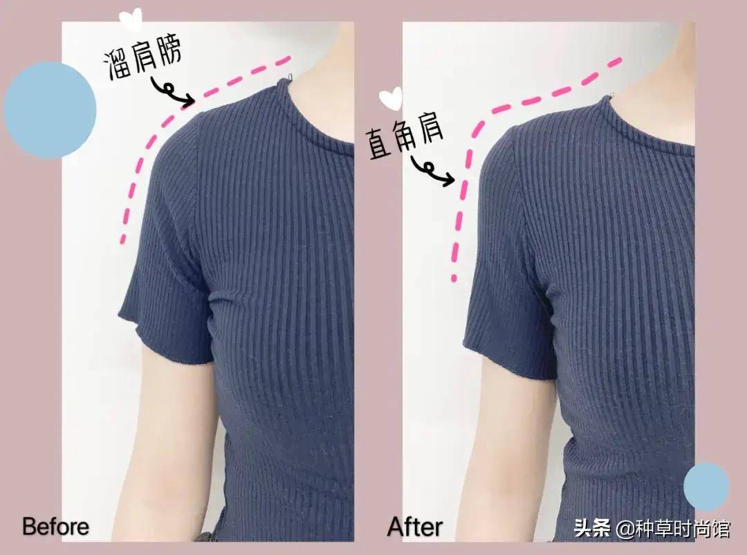 球球窄肩膀,溜肩膀女孩必须买!市面上有的垫肩
