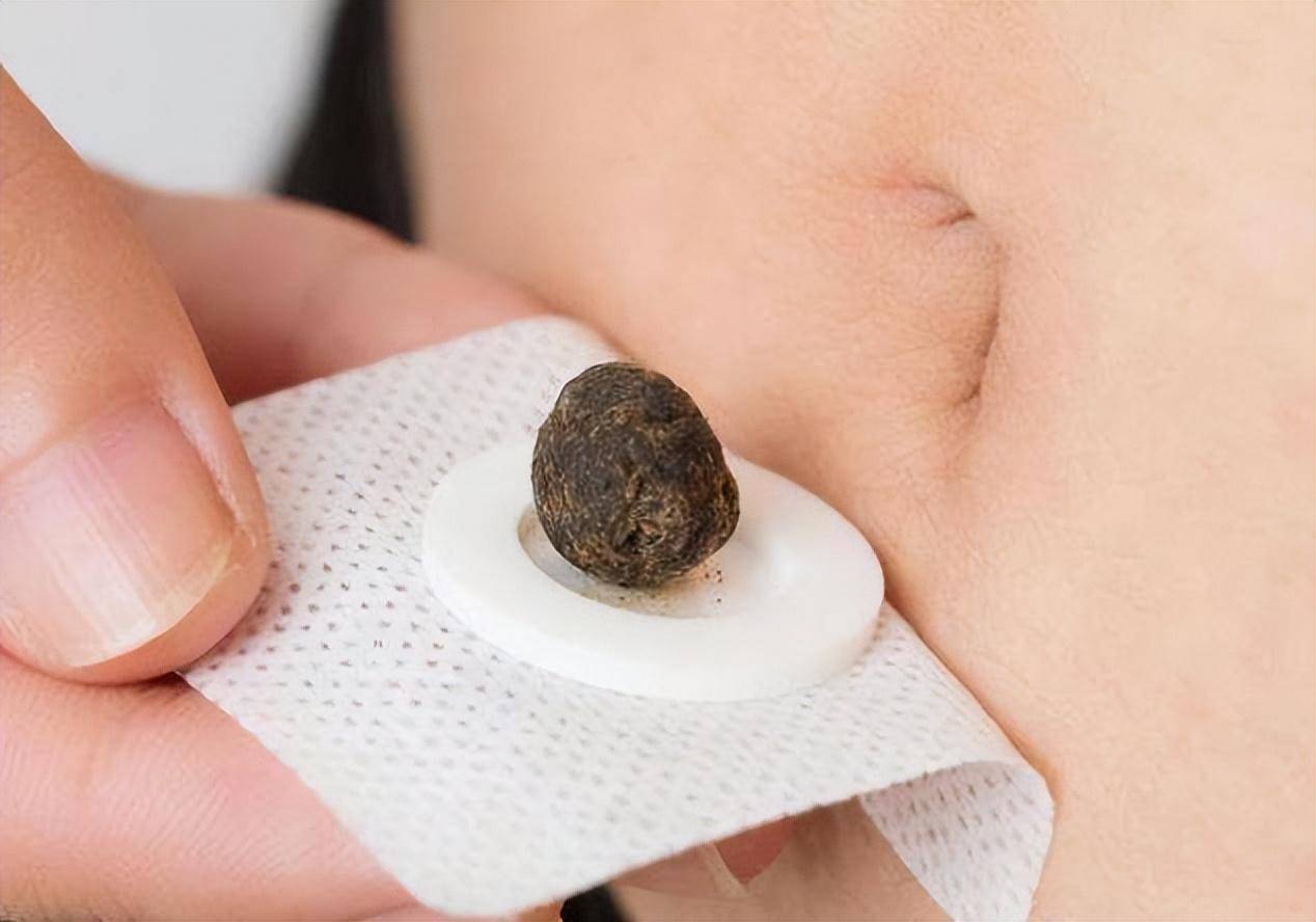 睡前常用"花椒"敷肚脐,一段时间后,或许会出现这5