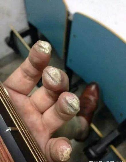 为了练吉他,他长出了满手的茧.白天朝九晚五地上班,晚上去酒吧驻唱.