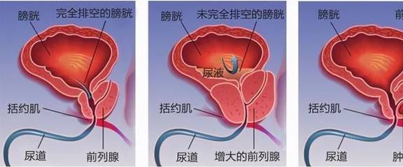 女性也有前列腺?为何只有男性发病?听听医生怎么说_唐女士_膀胱_患者