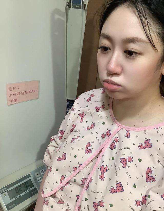 蔡允洁产后「大肚像怀孕6个月」公开肚皮照曝体重:才正要开始_蔡小洁