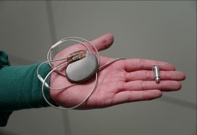 开启无线"外挂",攀西地区开展首例micra无导线起搏器植入_患者_团队