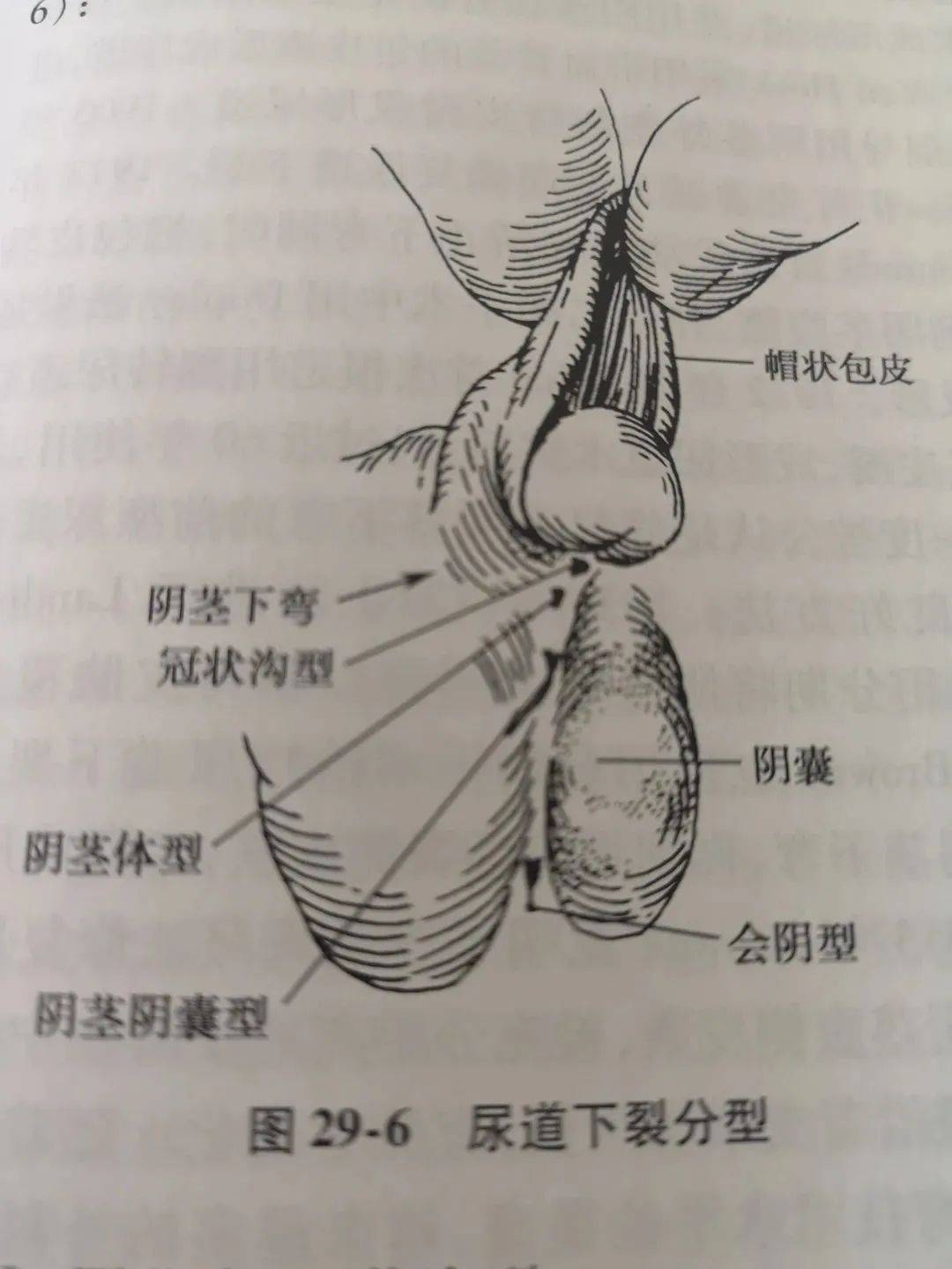 小男孩尿道图片