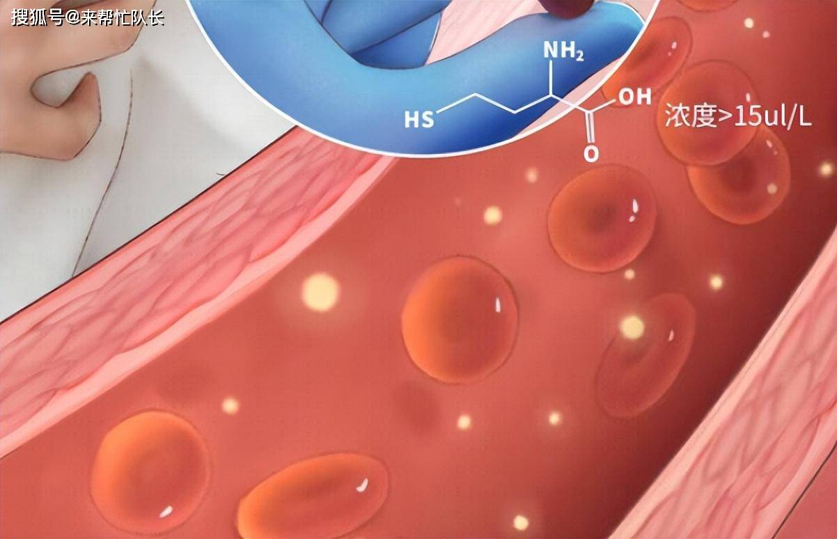 血液中的高同型半胱氨酸血症,有哪些病因?_水平_维生素_药物