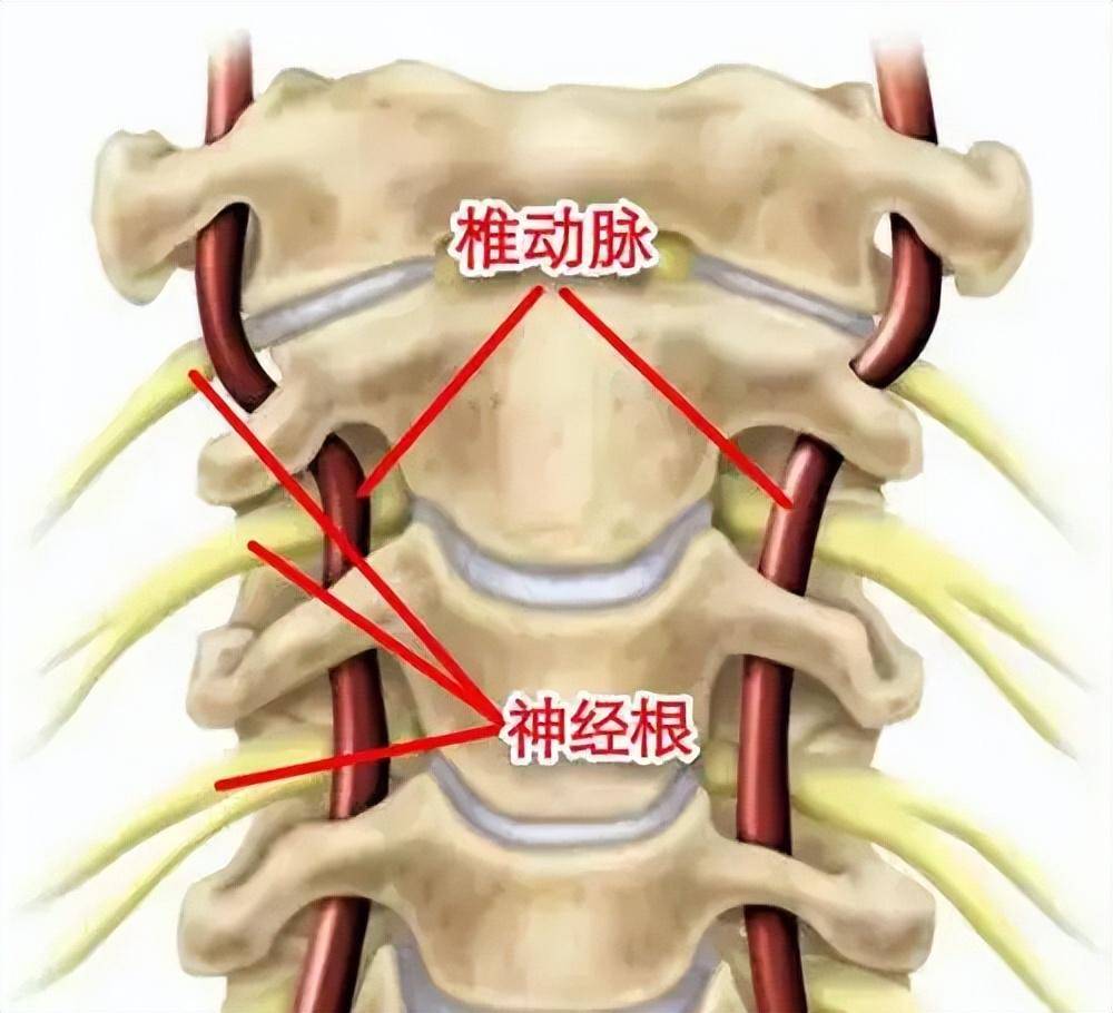 第六颈椎横突示意图图片