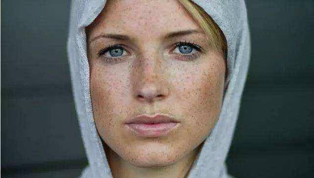 女生脸上有色斑?赶紧用生姜和它敷脸吧,美白祛斑效果太惊奇了!