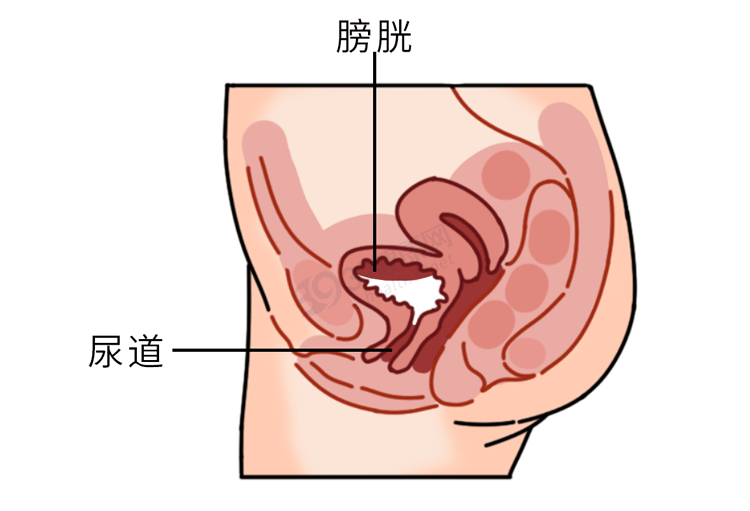 女性尿道感染尿液图片图片