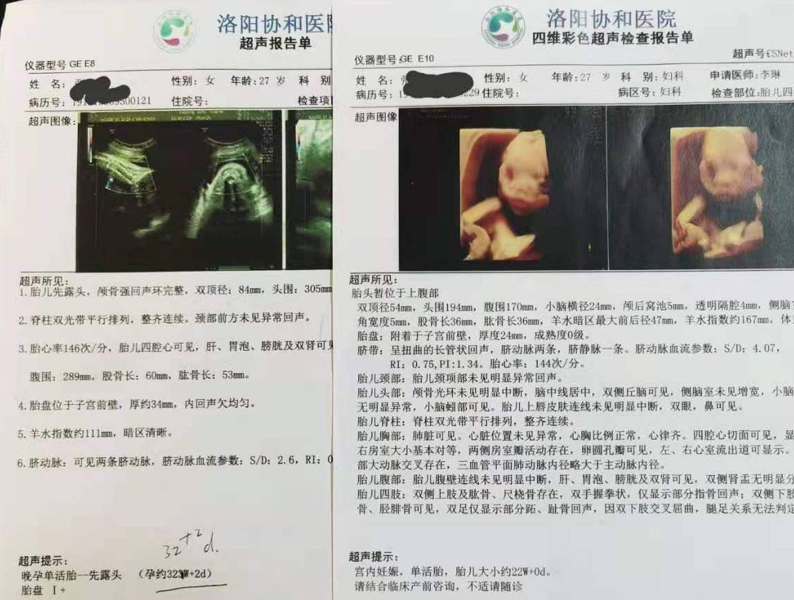 学到了吗（整蛊怀孕彩超单制作）下载制作假彩超单 第4张