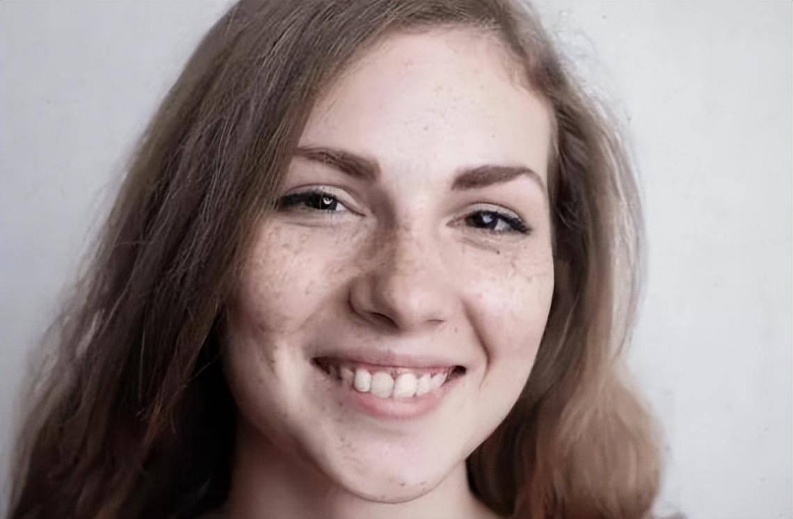 女人常吃白菜会加重面部斑点?