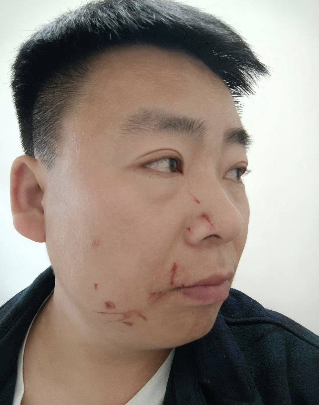 网红特效师合成自己与迪丽热巴接吻视频,脸被粉丝挠伤,网友点赞_技术