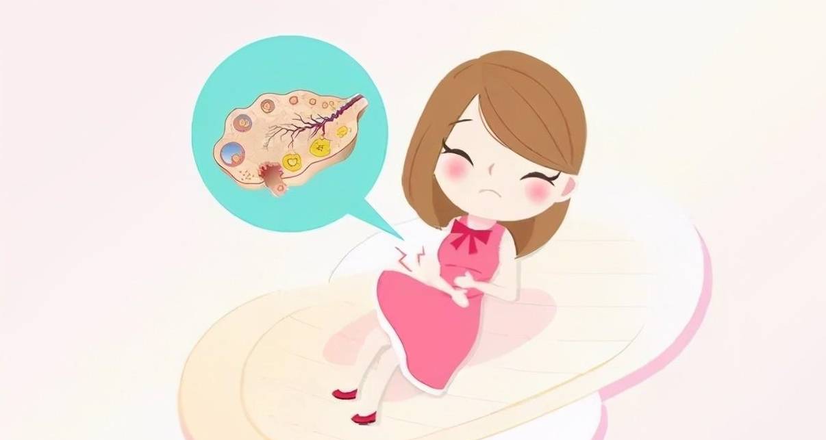 多囊的症状,你真的了解吗?这些细节一定要注意_患者_治疗_卵巢