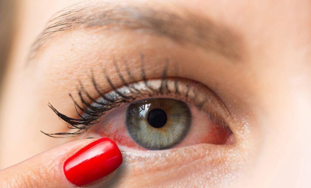 一个护眼中成药,解决眼睛干痒,发红,疼痛,治疗结膜炎,睑缘炎_热气