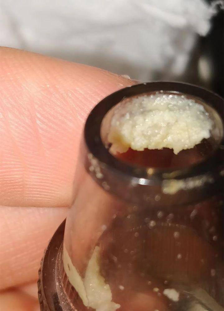 鼻子上挤的白条条的东西是脂质微丝吗?_黑头_毛孔_油脂
