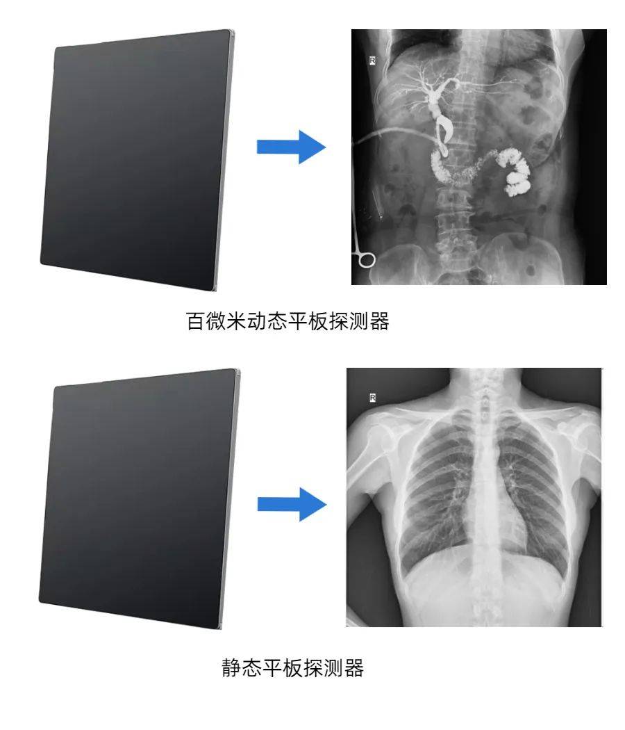 悬吊动态DR是什么意思？悬吊动态DR用途及临床优势介绍(悬吊dr是什么意思)