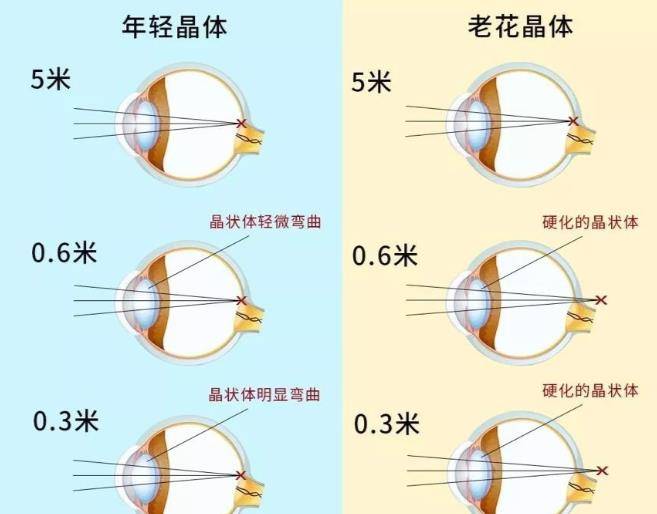 我二叔,年轻的时候近视,上了年纪老花眼!_眼镜_视力_物体