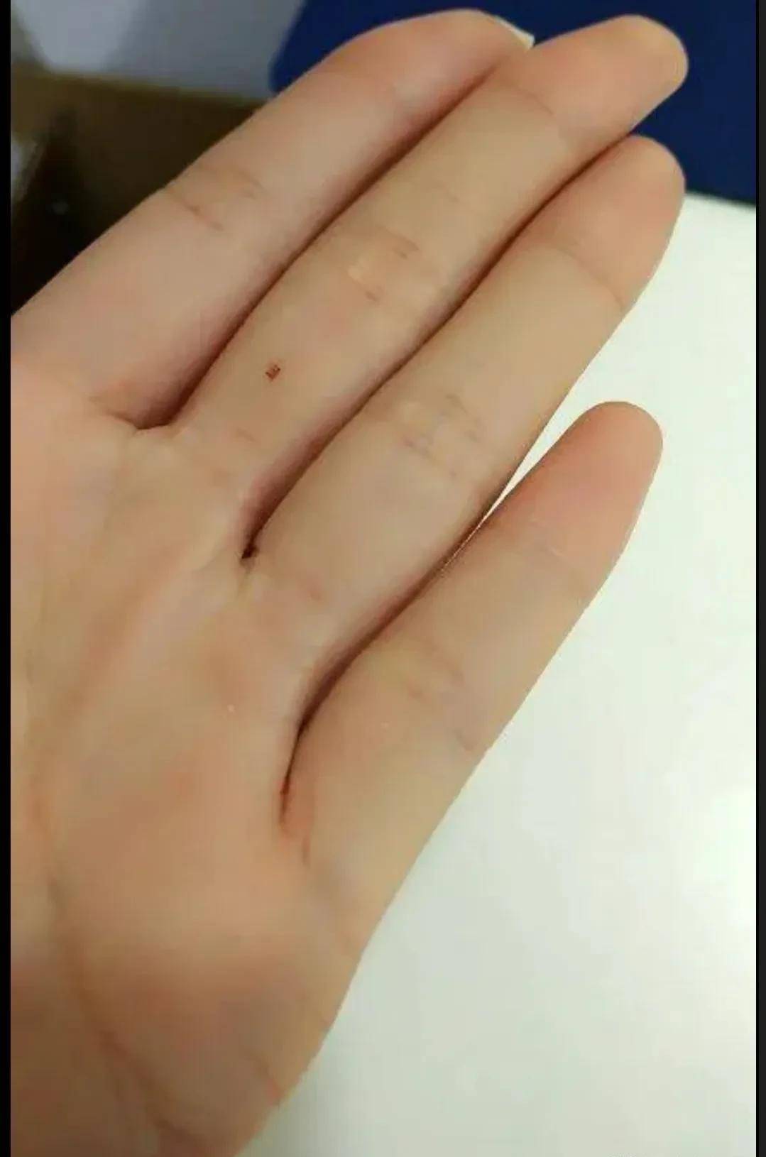 右手食指有痣的女人图片