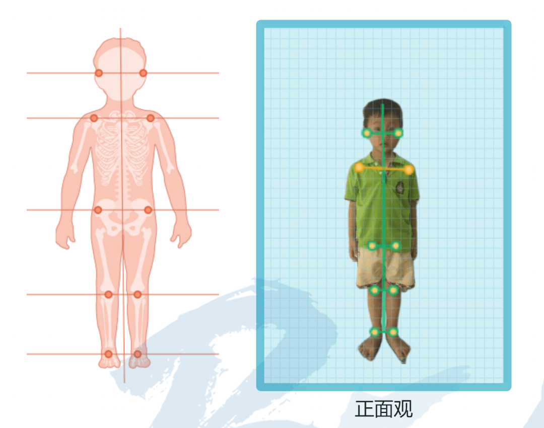 教练必修丨儿童体态评估操作指南,建议体培机构收藏!_骨盆_问题