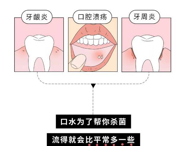 口腔_唾液腺_治疗