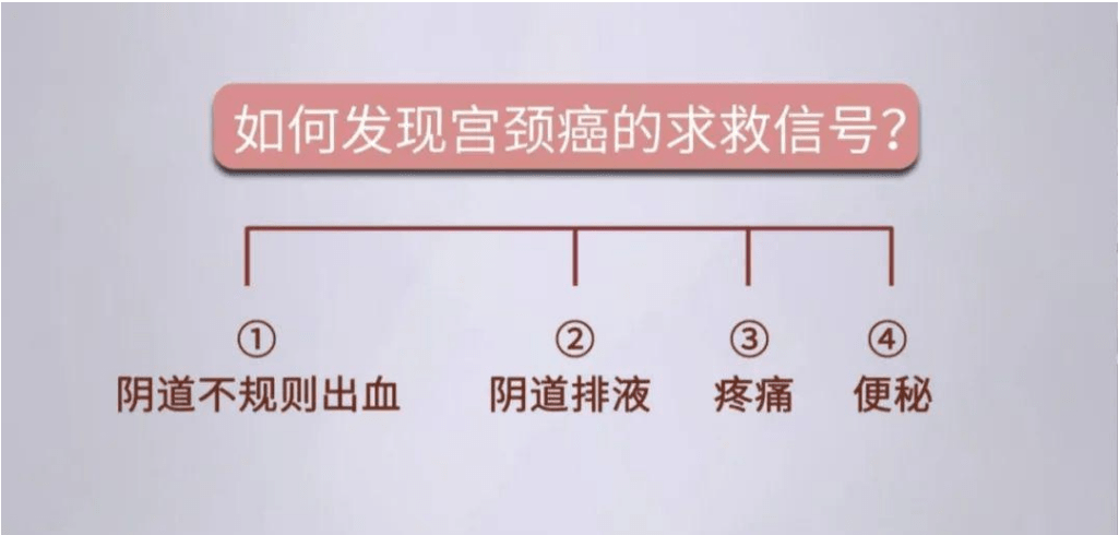 宮頸癌的3個早期信號,一定要注意!_陰道_女性_檢查