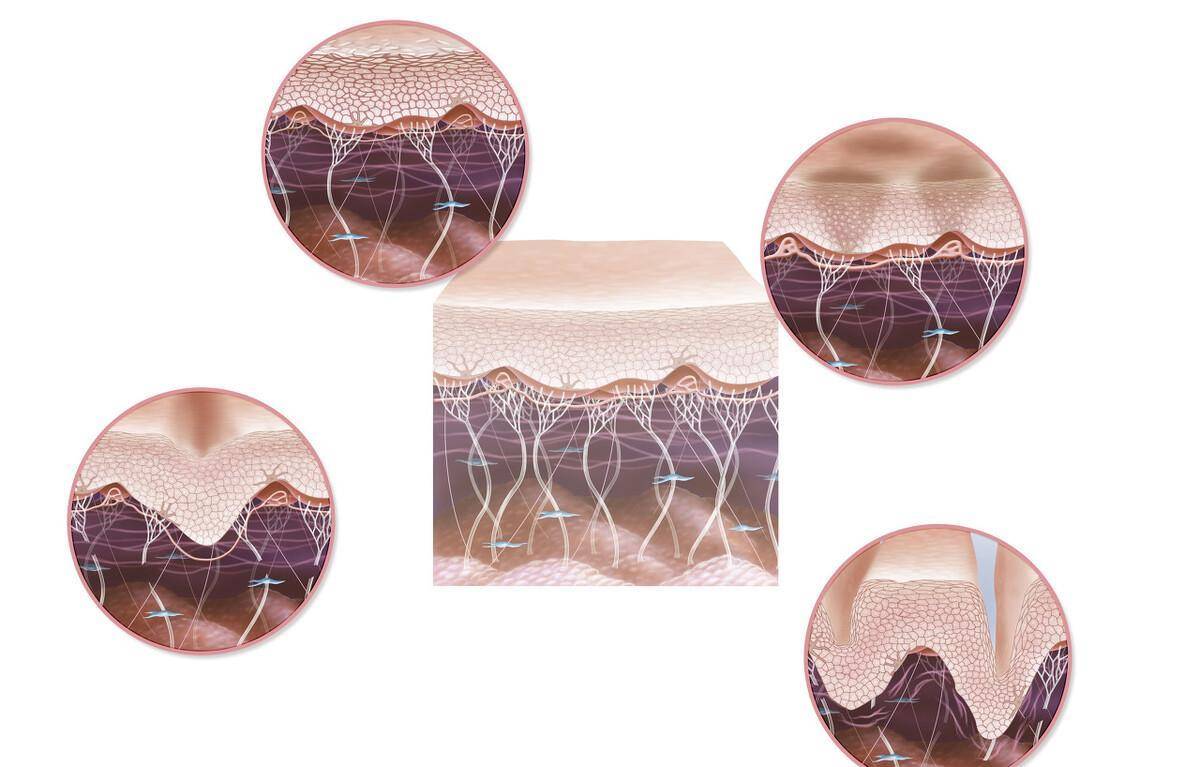 纤维蛋白胶是一种止血材料 2023-2028年市场发展潜力大_凝血酶_应用