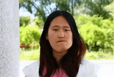 杏林小秋"歪脸女孩"受整形机构无偿捐助后 不忘初心甘当教师_梦想_秋