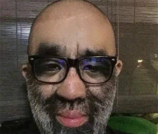 "毛孩"于震寰浑身长满毛,被投资1000万包装,41岁迎娶90后娇妻_时候
