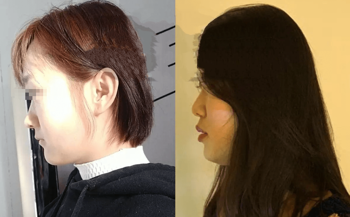 还在给你的孩子睡扁头?这样的父母快醒醒!孩子将来会恨你的!