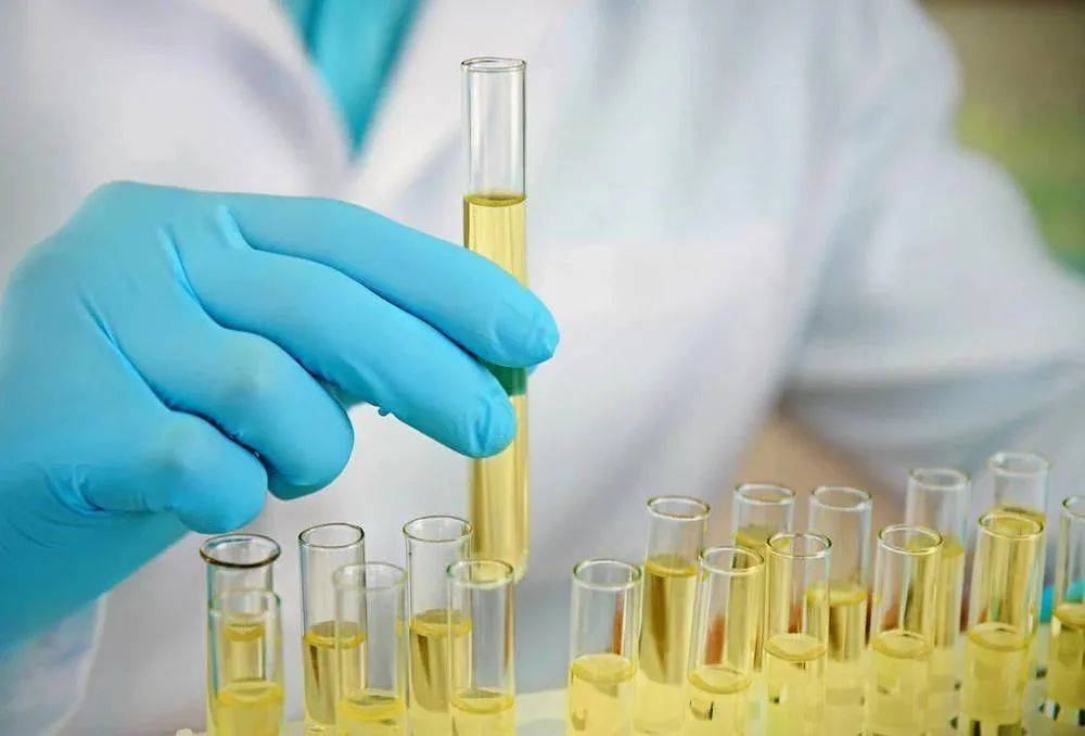 家佳诊尿液分析仪:糖尿病患者为何要尿检? 尿常规 目测试纸