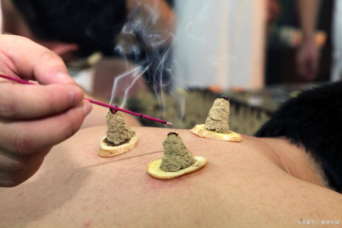 中医脐疗师怎么报考?报考条件是什么?就业前景怎么样?_相关_养生_机构