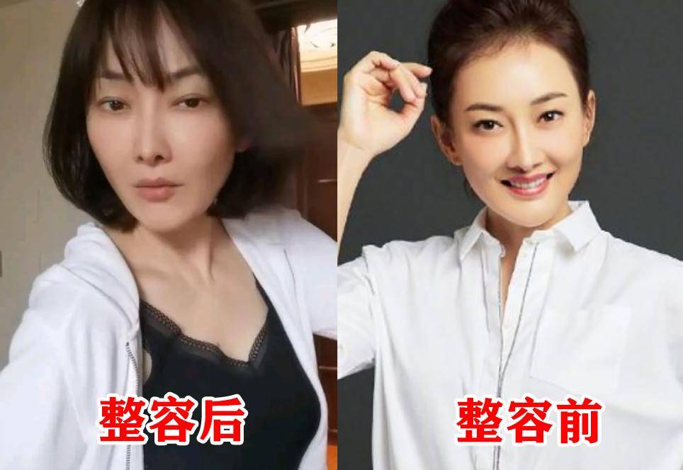 49岁牛莉整容变化大,脸僵鼻子假难认出,评论区沦陷本人疑回应_视频