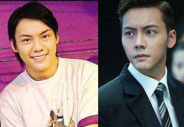 男星整容前后差距巨大,黄晓明变男神,陈伟霆像换脸,你还知道谁