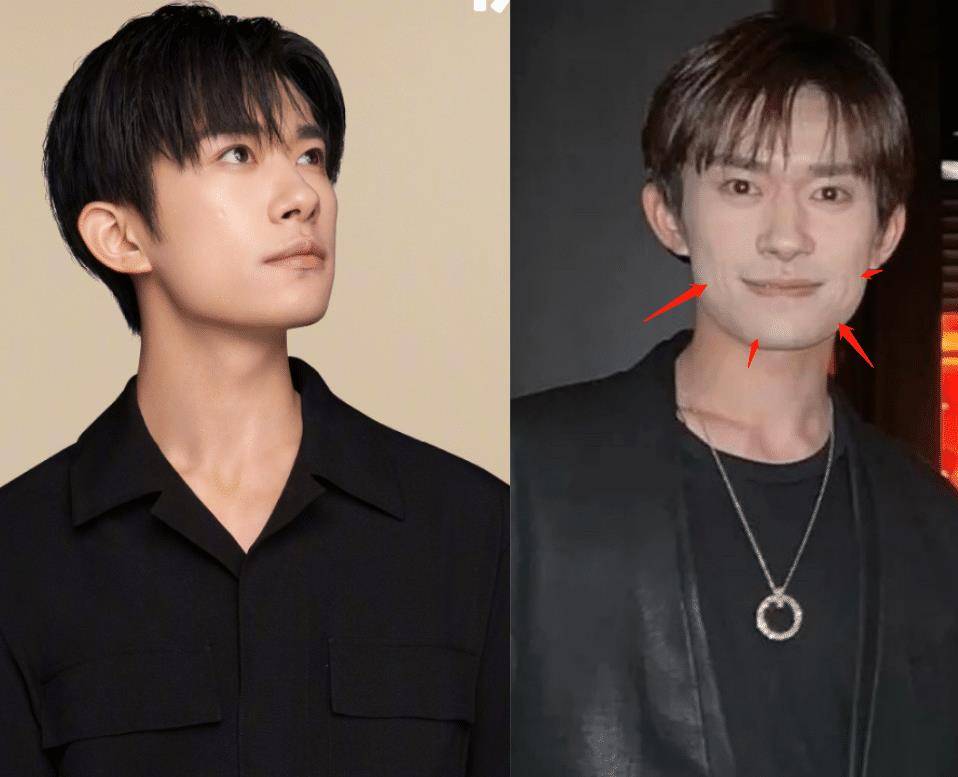 易烊千玺无修真实生图:鼻宽口阔络腮胡茬,脖子没涂粉,被指普男_爱凌