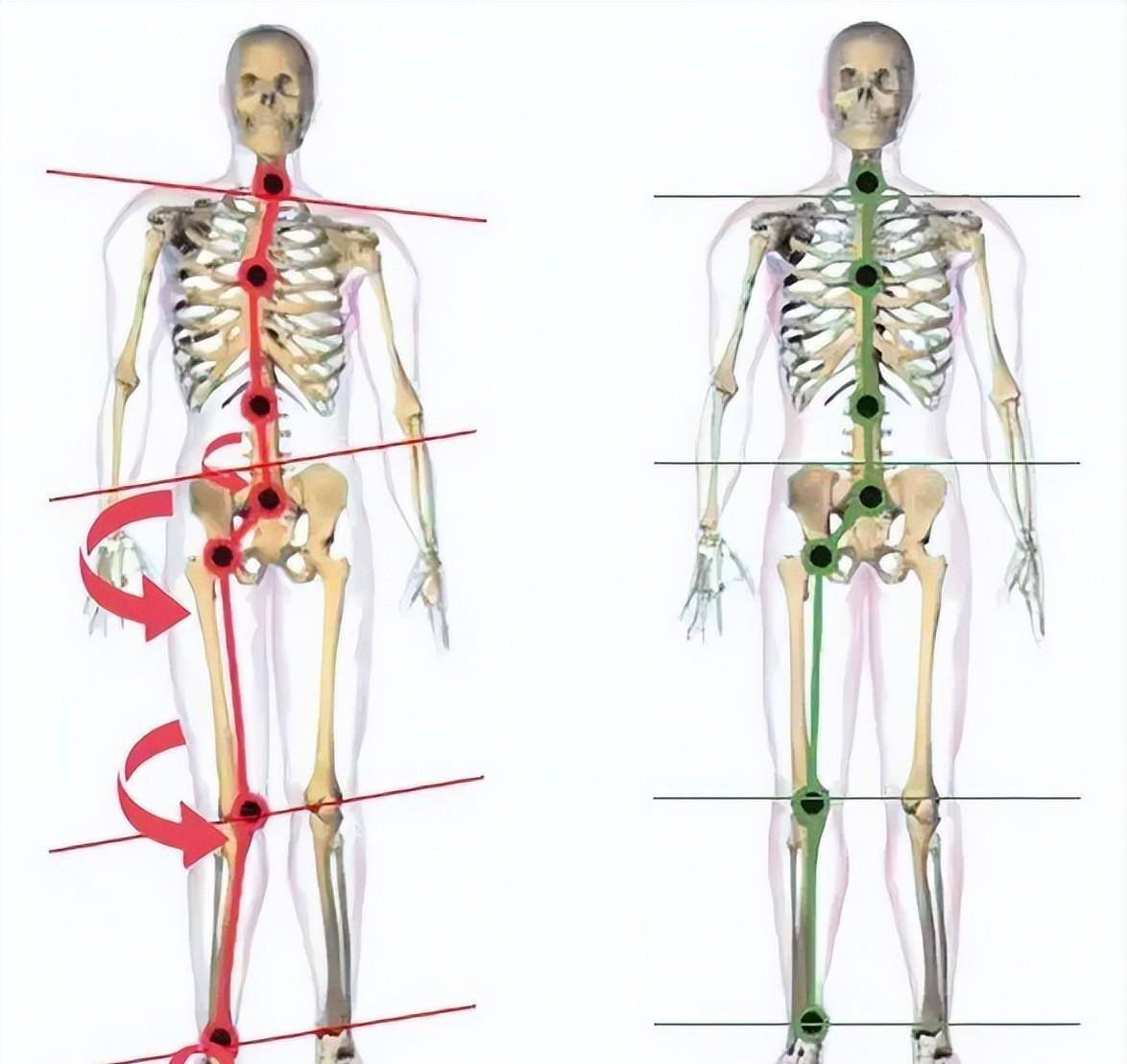 40岁王心凌身材似少女,驼背,小肚腩如何破?