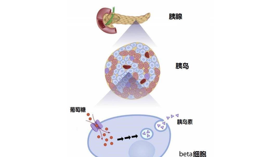 经常被胰岛素抵抗折磨的糖友们,学会这2点,帮你轻松改善