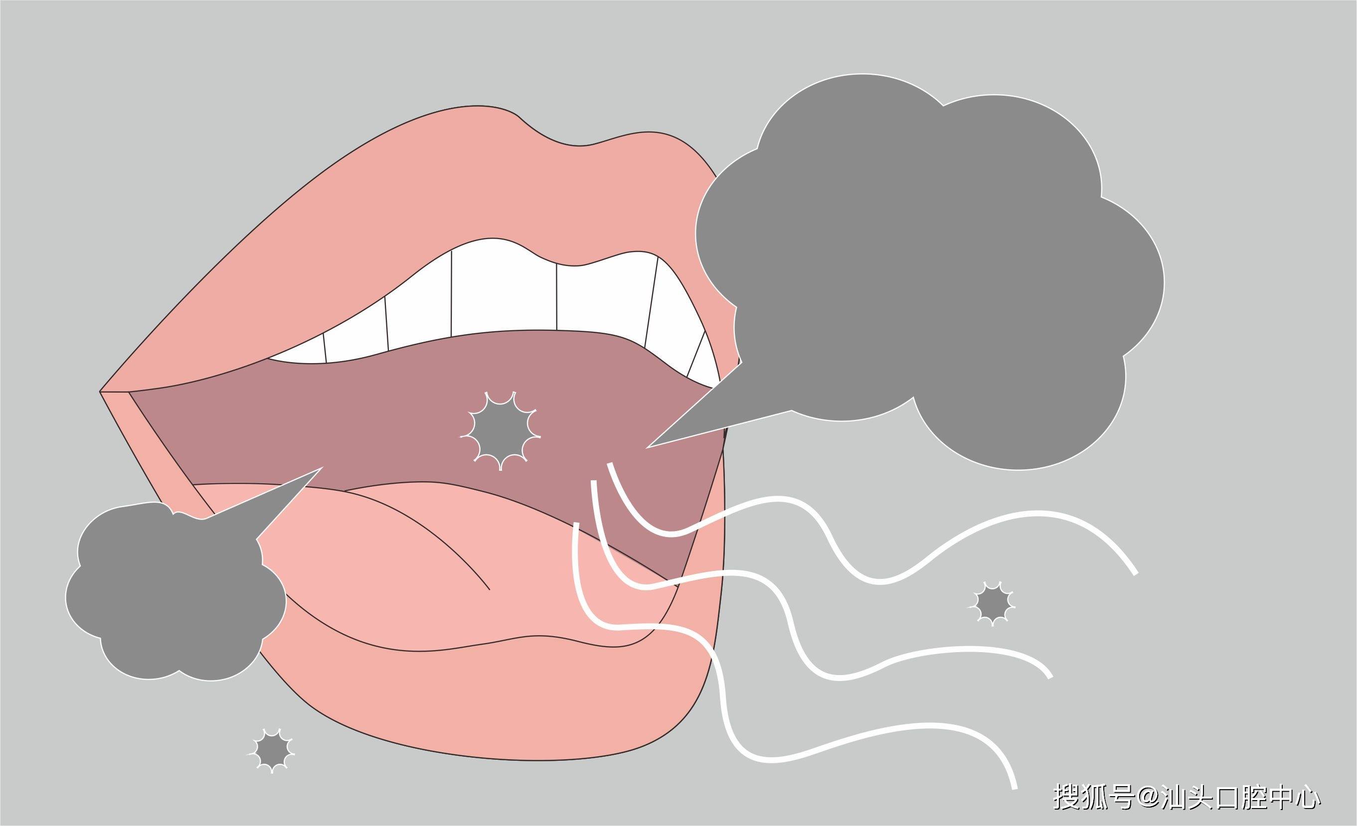 520快到了,口腔有异味怎么办?带你揭开口臭的真面目_舌苔_治疗_食物