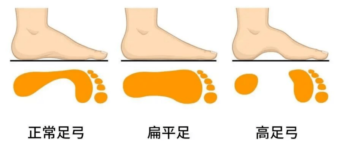 让双足守护健康,从一个脚印开始……_运动_足部_肌肉