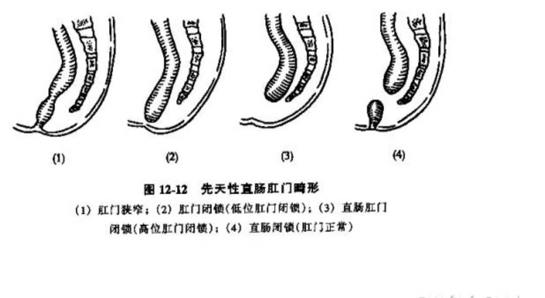 肛门二道门图片