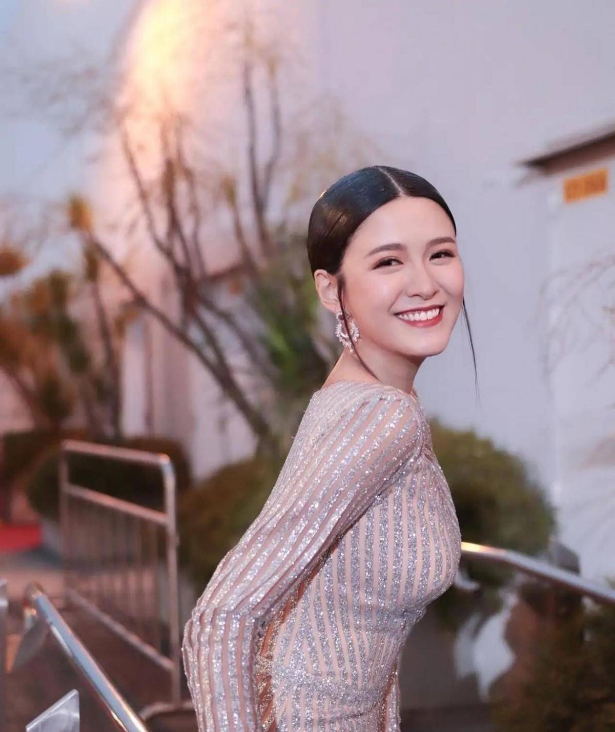 江嘉敏不愧被誉为"小周慧敏",穿条纹裙优雅贵气,身材也很优越_衣服