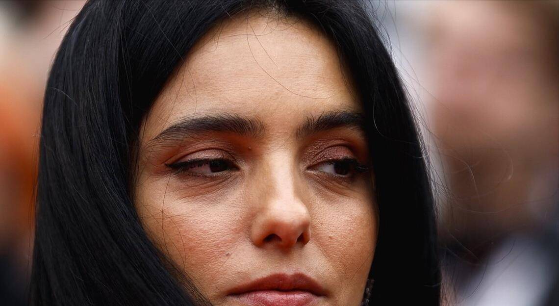 皱纹,下垂,整容脸,明星完美颜值都是假的_造型_身材_汤唯