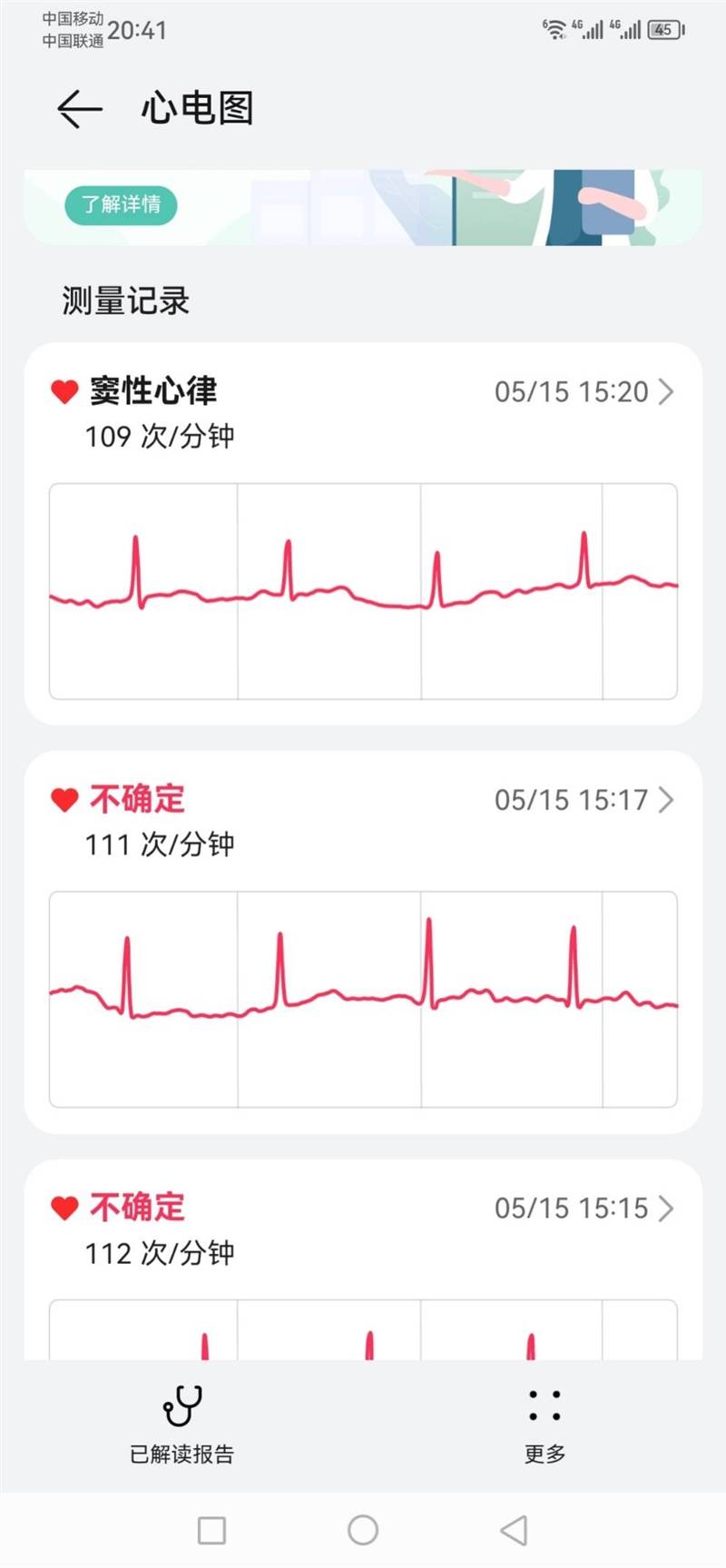 走速,导联等相关数据一并展出,相当专业,与医院体检所出据的测试报告