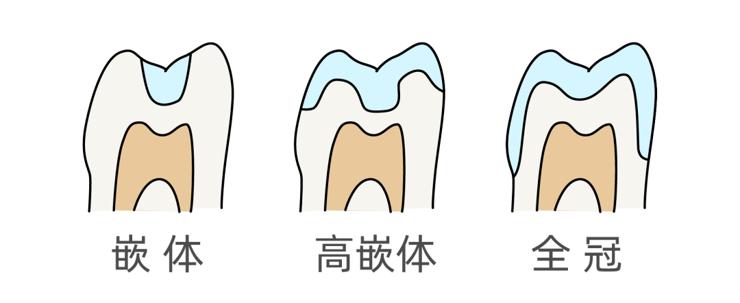 牙冠轴面图片