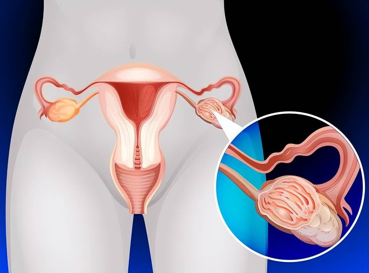 卵巢早衰的原因有哪些 卵巢保养有必要吗